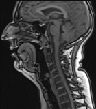 MRI - Copyright - Stefanie Rummel MRI - Copyright - Stefanie Rummel